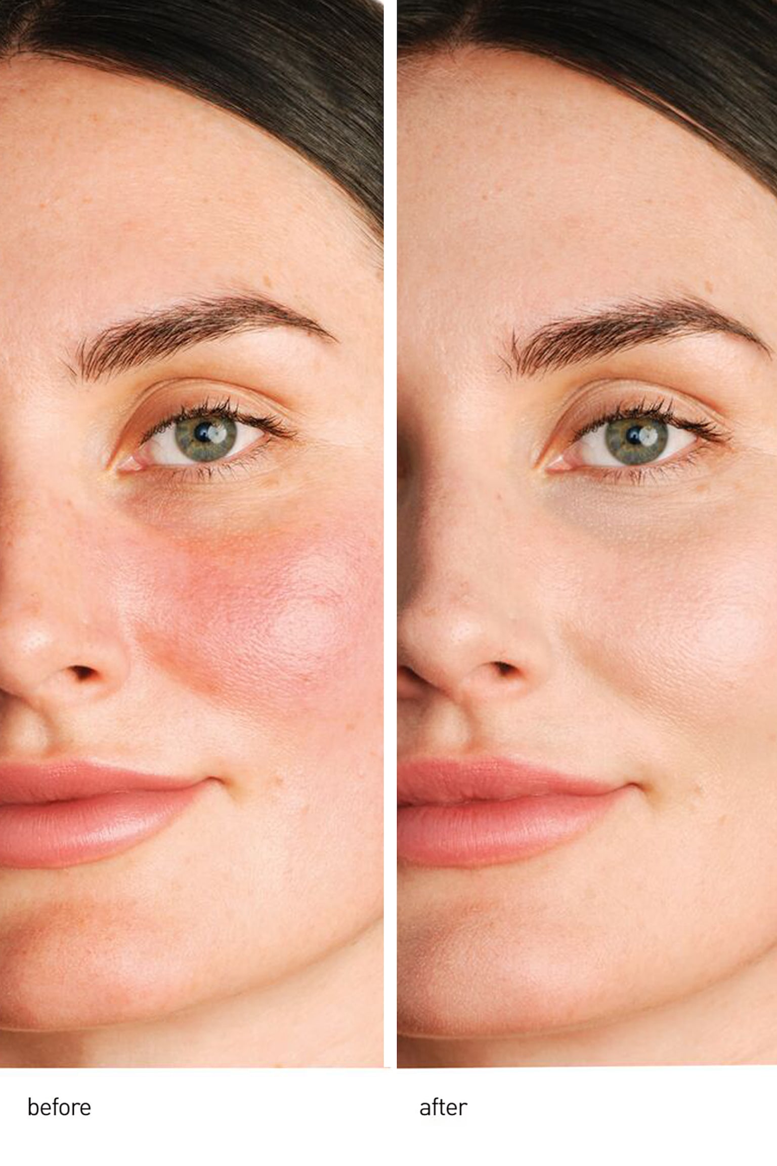 Centella Red Face Serum - Gennemsigtig - 3