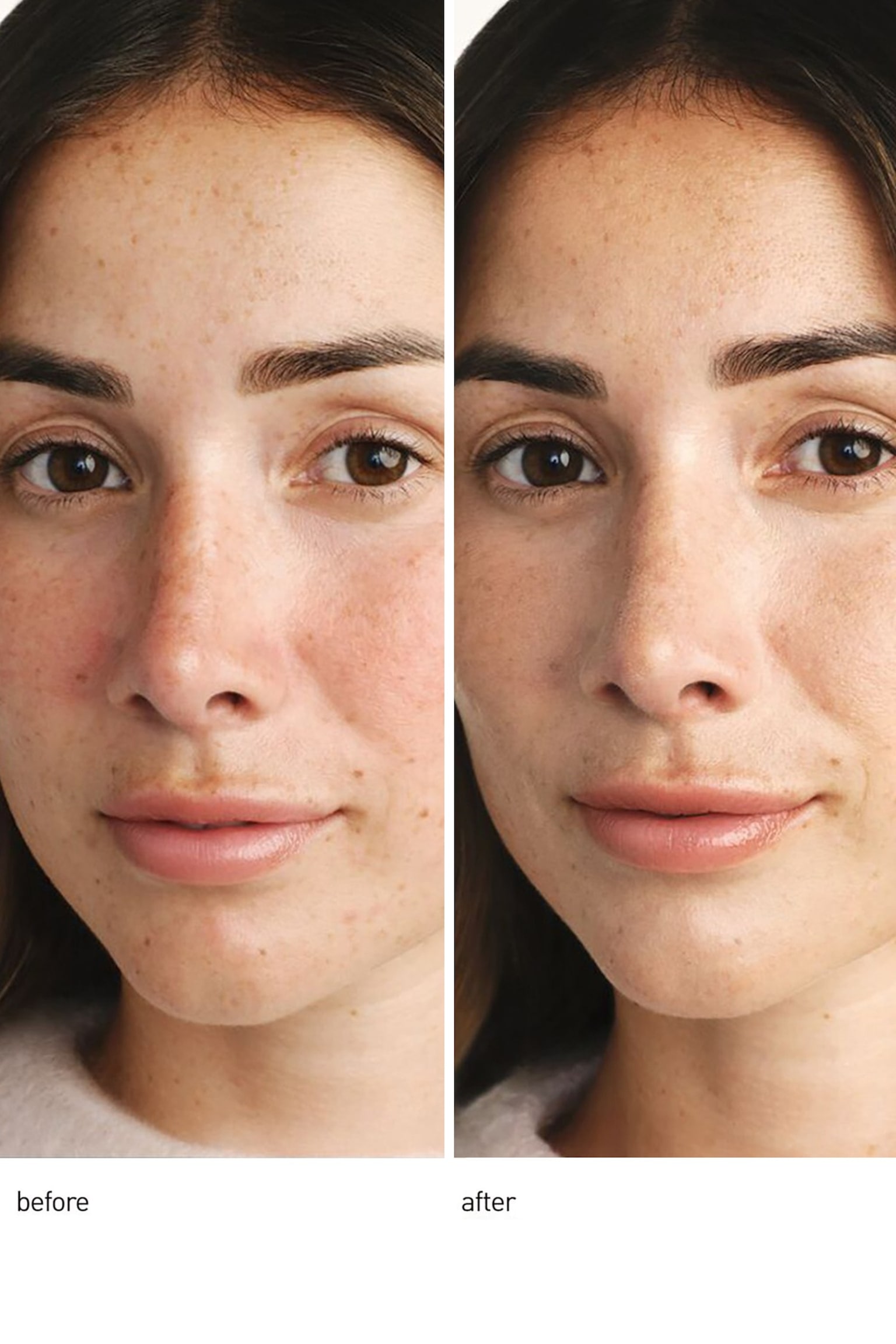 Centella Red Face Serum - Gennemsigtig - 2