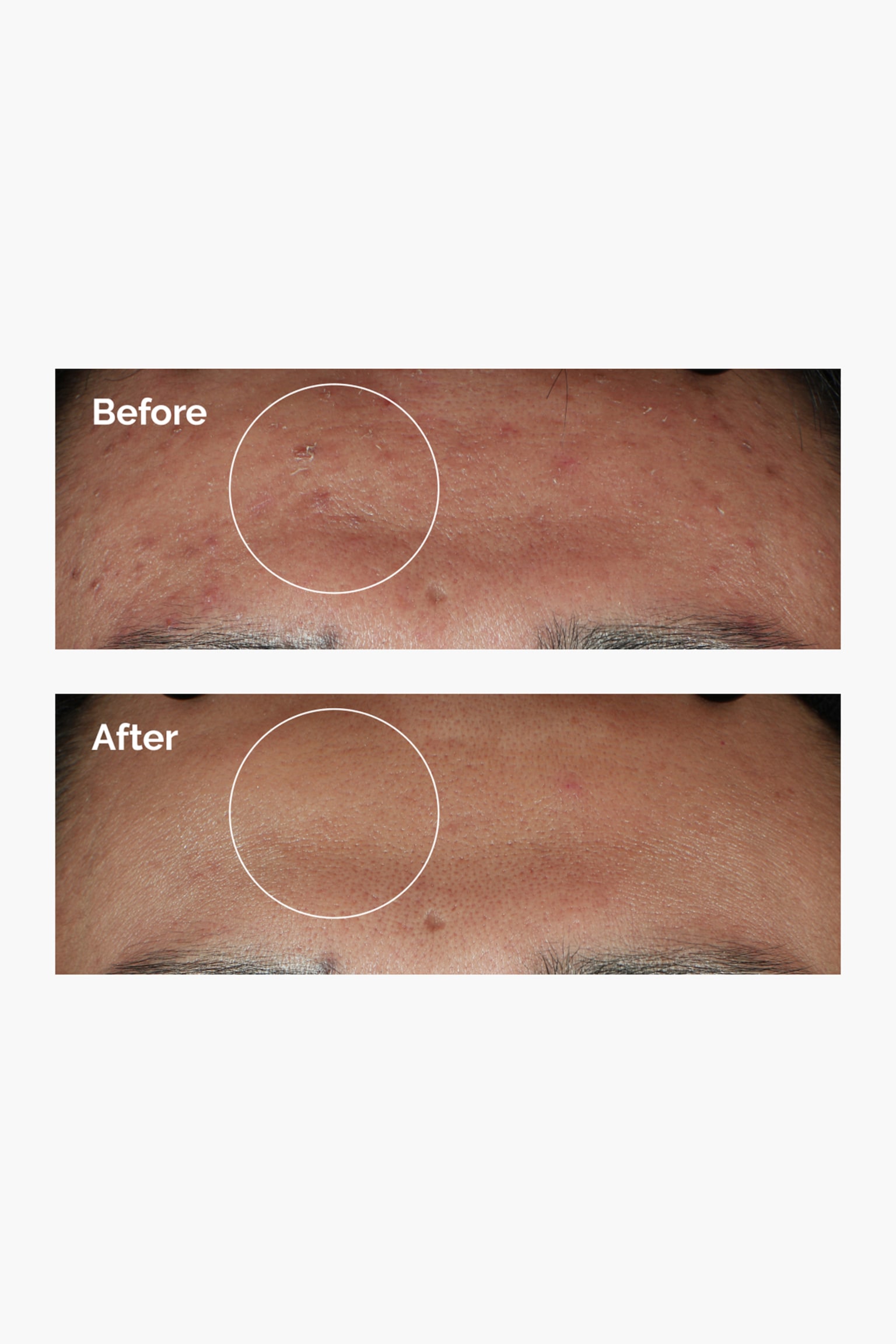 Niacinamide 10% + Zinc 1% - Weiß - 5