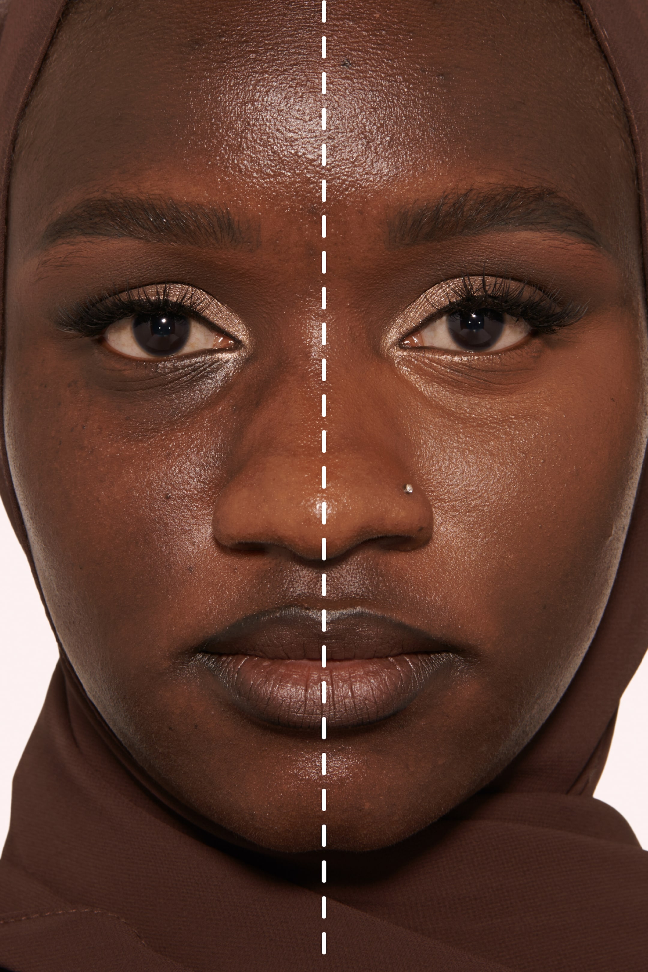 Visa större bild: Ett närbild av ett ansikte visar en vertikal delning, som illustrerar en före-och-efter-jämförelse av hudens utseende. Den vänstra sidan visar ojämn hudton och synlig textur, inklusive missfärgning under ögonen, medan den högra sidan uppvisar en slätare, jämnare hy med finare textur.